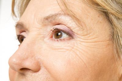 Менопаузальное старение кожи. Основные эстетические проблемы