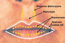 коррекция губ